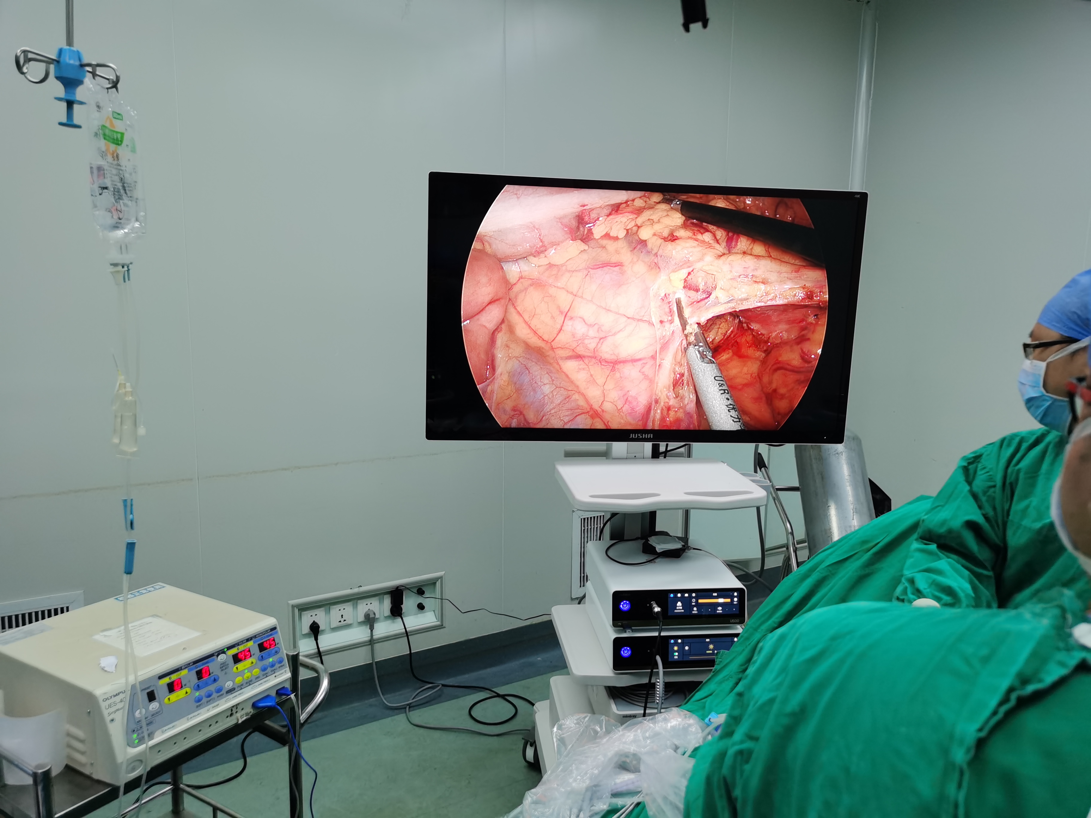 5bee3f69-5376-4286-a515-07cecca52c82